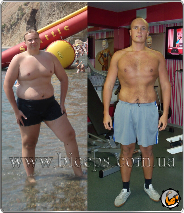 До и после похудения - Доктор Борменталь