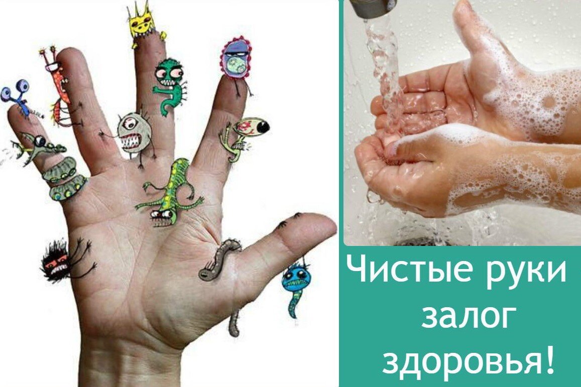 Энтеробиоз