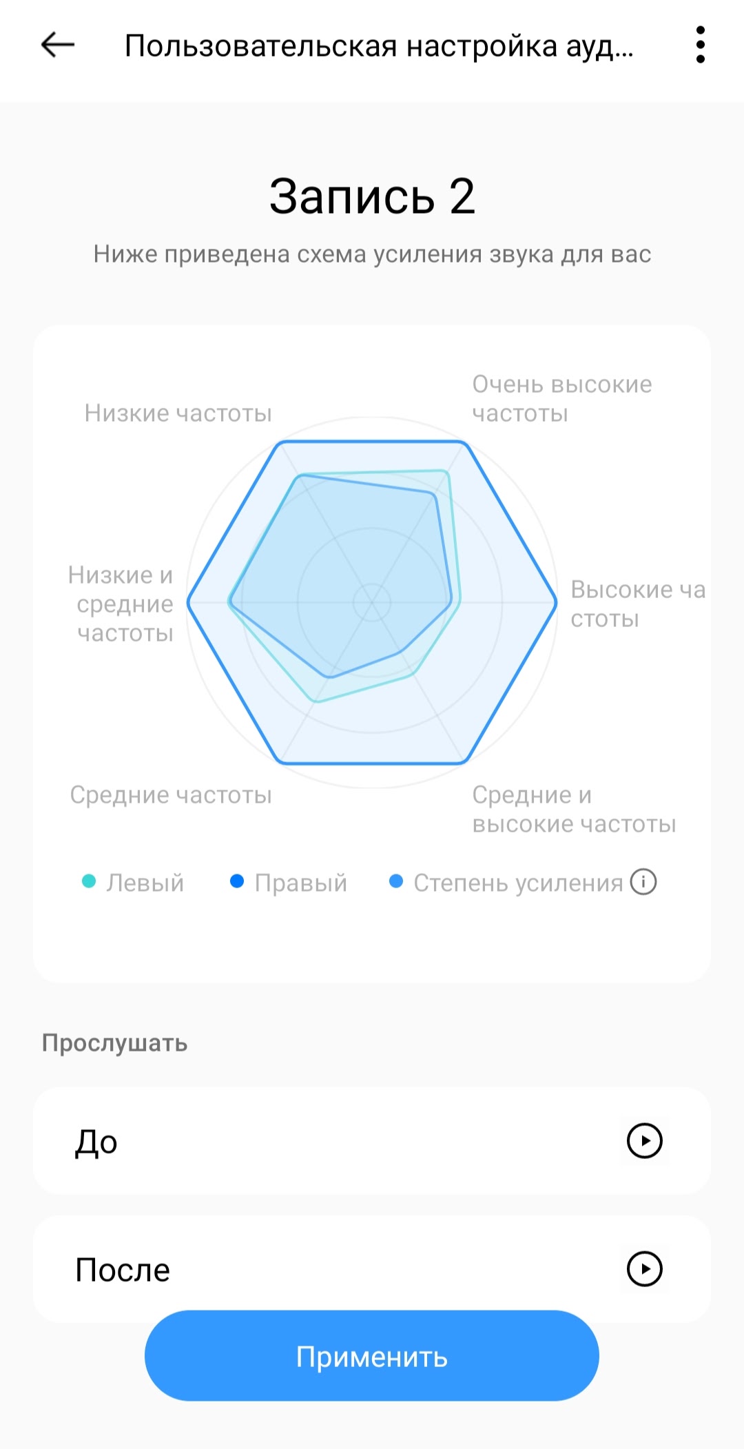 Обзор TWS-наушников Realme Buds Air 3: Все хорошо, но где же звук?5