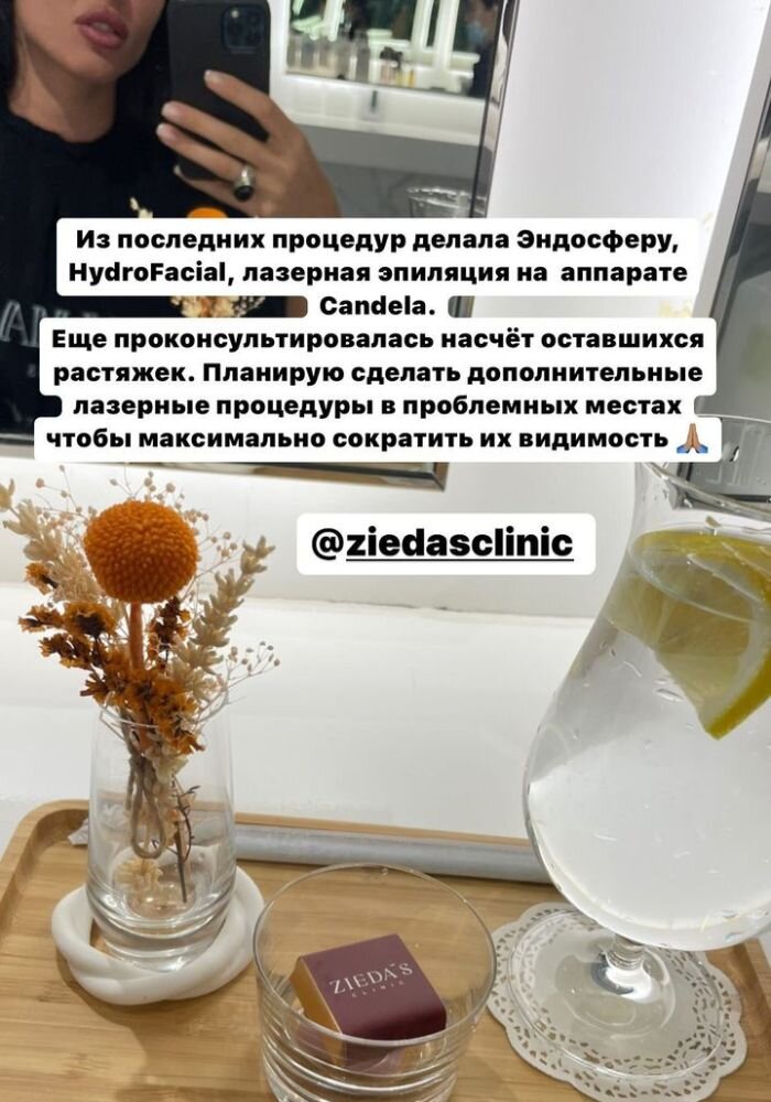    Анастасия Решетова рассказала, как борется с растяжкамиСоцсети Анастасии Решетовой