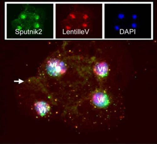     Паразит паразита паразита: как внутри крохотной амебы процветает большой вирус