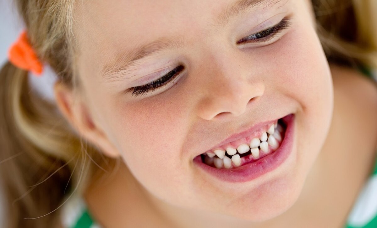 клыки в 10 лет