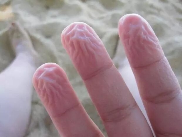 Почему мокрые пальцы покрываются морщинками | укатлант.рф - интересный журнал | Дзен