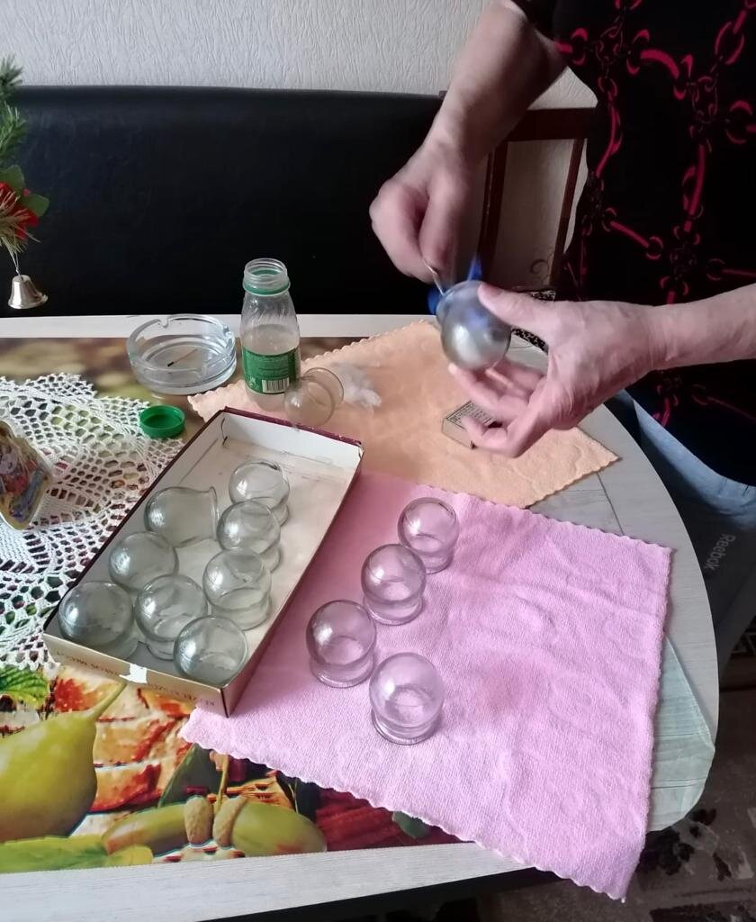 Технология постановки банок. Астрахань (2023).