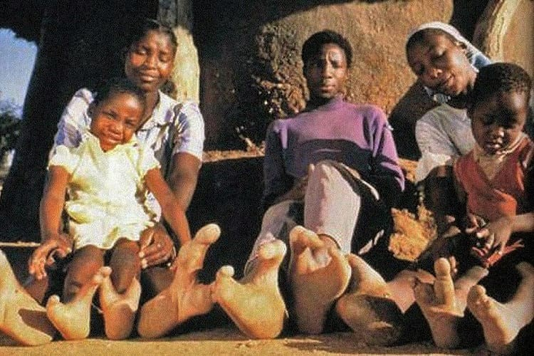 Откуда ноги растут: история двупалых — загадочного племени «‎людей-страусов»