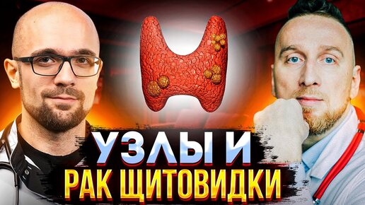 Рак щитовидной железы – что это? @Занимательная эндокринология @Доктор ...