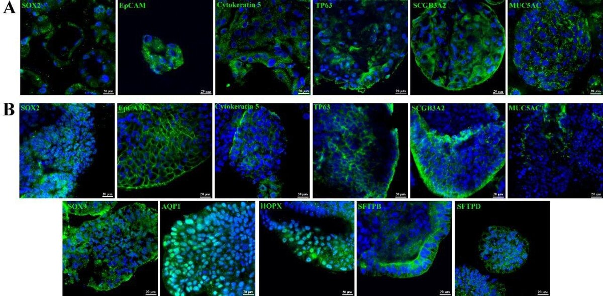 Окрашенные антителами различные типы клеток легких и бронхов. Окрашивание подтверждает, что эти клетки присутствуют в полученных органоидах