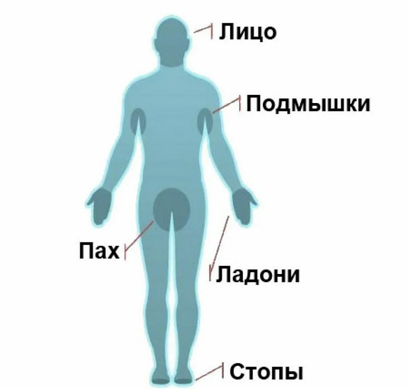 Сильно потеет пах. Повышенного потоотделения. Зоны повышенного потоотделения у человека. Гипергидроз локализация. Локализованный гипергидроз что.