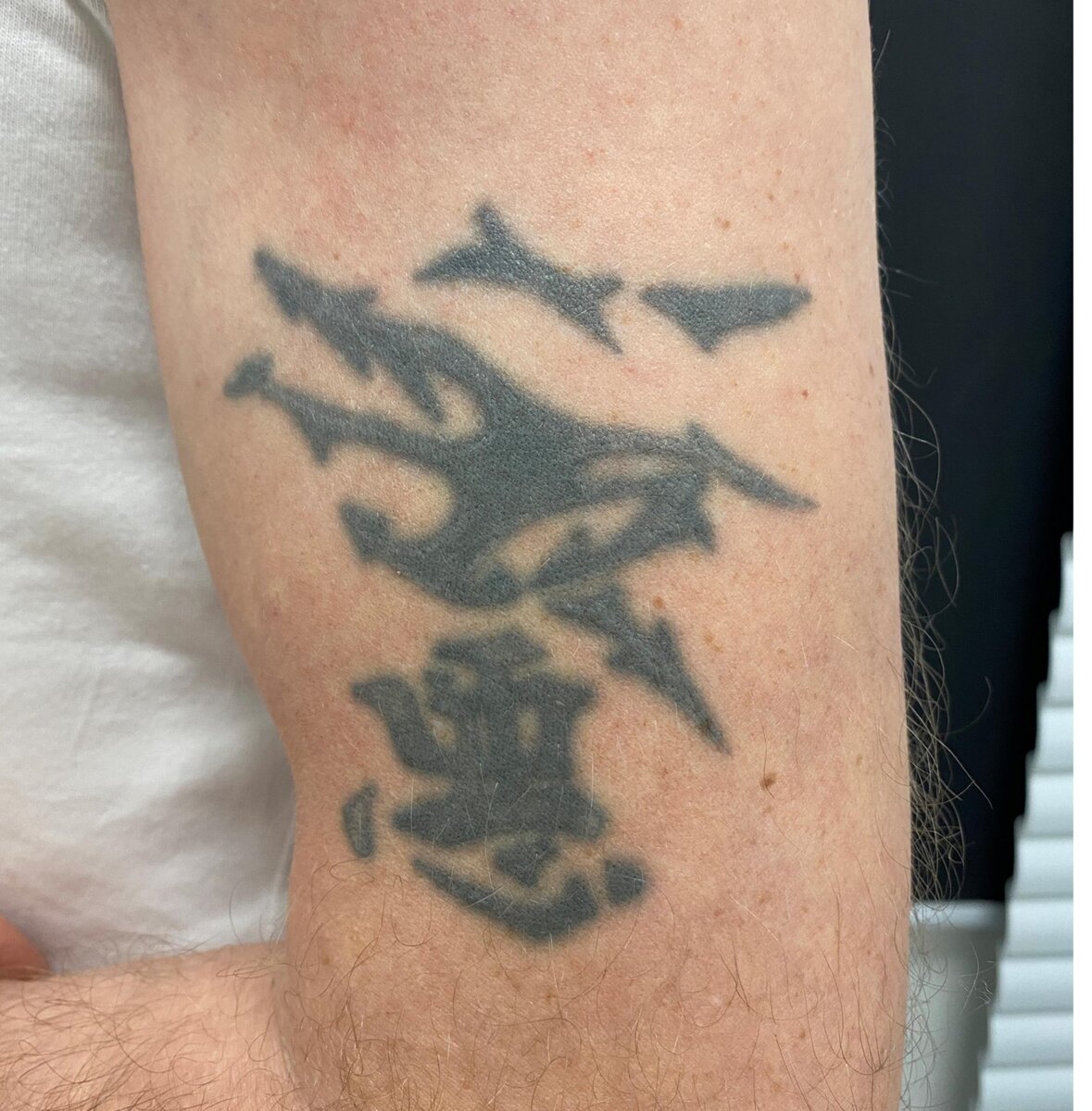 Фото тату до процедуры