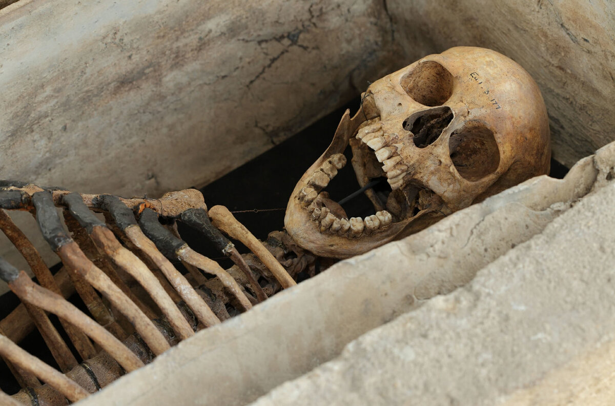    Если тело человека после смерти в течение длительного времени находится в сухом хорошо проветриваемом месте, то ткани начинают быстро терять влагу и высыхать - происходит как бы естественная мумификация тела. Труп теряет до 9/10 своей первоначальной массы, уменьшается в объеме, кожа становится плотной, приобретает буровато-коричневую окраску, внутренние органы уменьшаются в объеме, становятся сухими