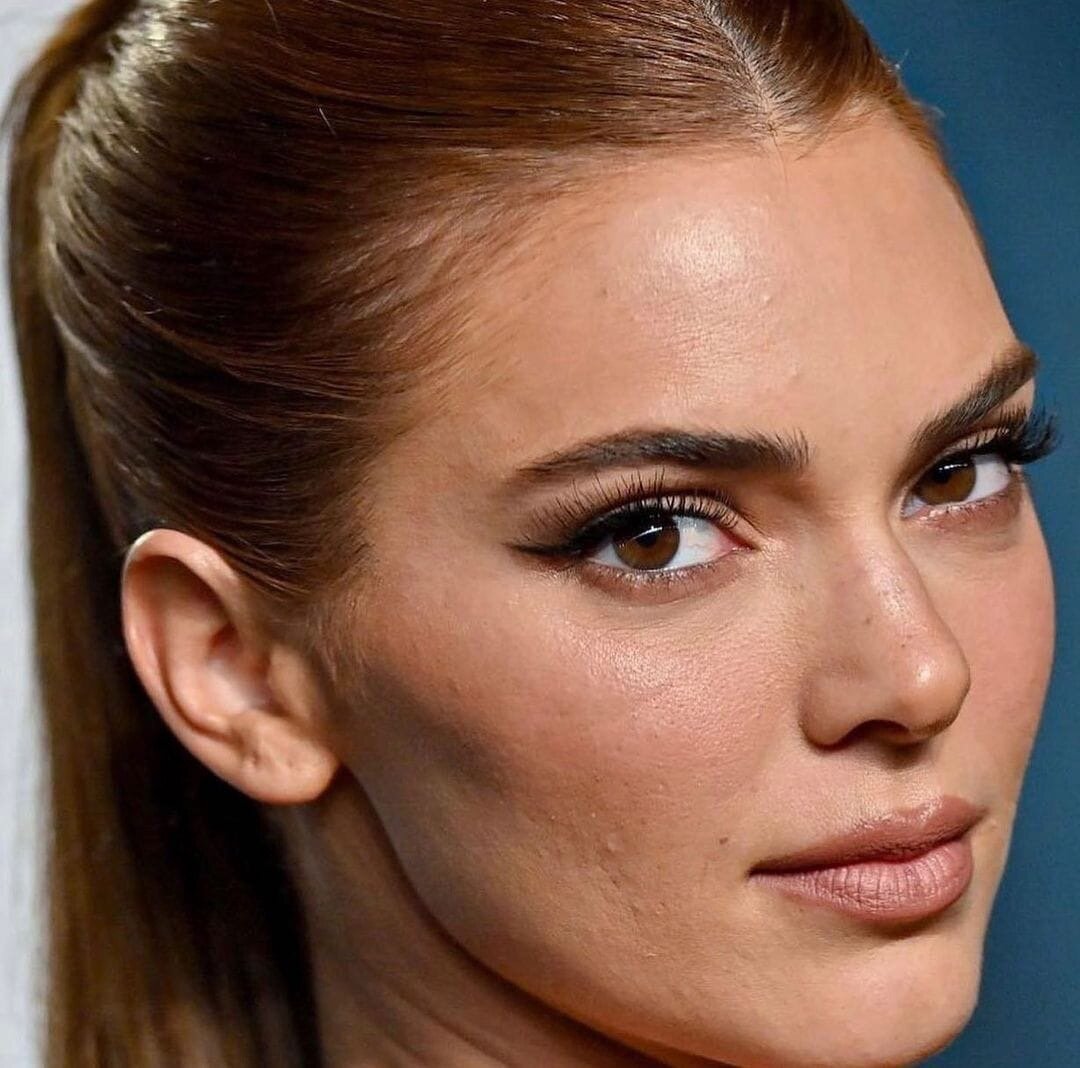 следы от постакне на правой щеке ближе к губе, пигментация на носу, несколько небольших прыщиков и мимические морщины на лбу