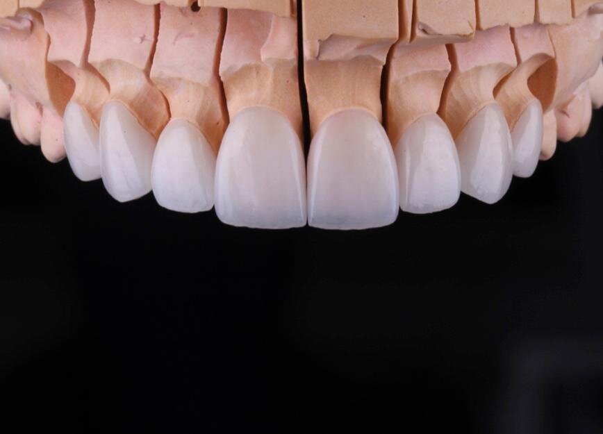 Кому-то подойдут такие. Немного вытянутые и с более нежными уголками, не ярко выраженными клыками. Личное фото.