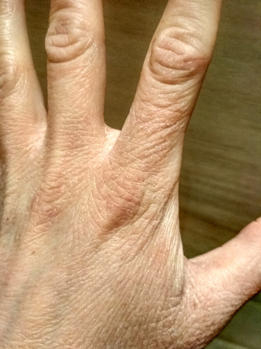 Накануне использования маски