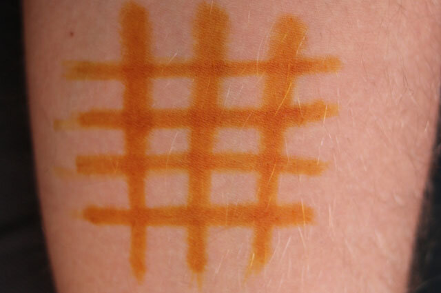 Вот примерно такой должна быть йодовая сетка 