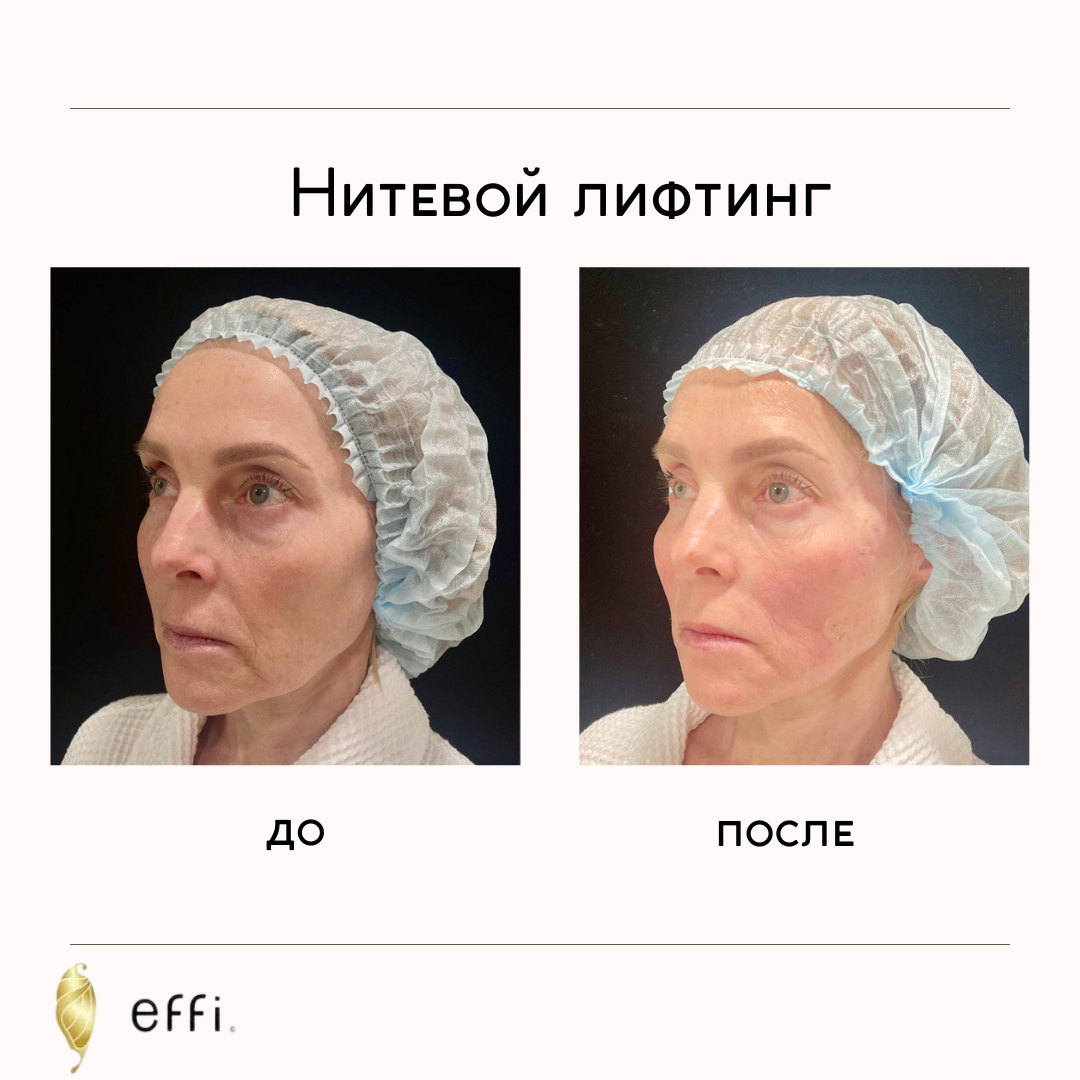 Врач косметолог Беер Ирина Николаевна