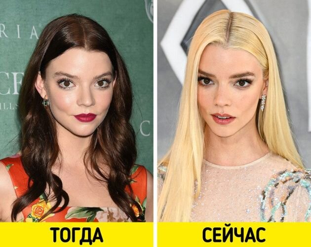 Анна тейлор джой до и после пластики