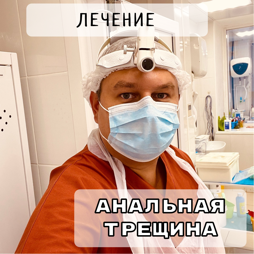 Лечение анальных трещин: всё, что нужно знать | Гаврилов Василий ...
