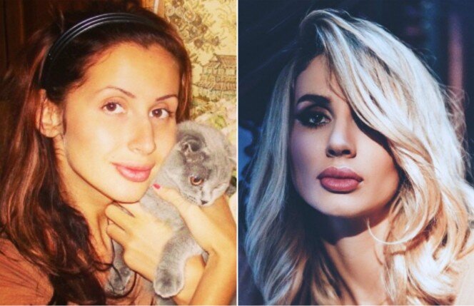 Светлана Лобода не делала пластику