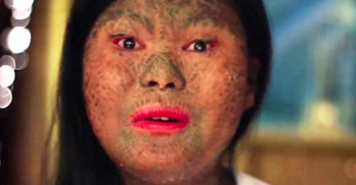 Девочка со змеиной кожей