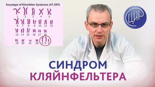 Синдром Кляйнфельтера. Причины азооспермии. Мужское бесплодие. Уролог-андролог ЦИР Живулько А.Р.