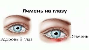 взято из общего доступа
