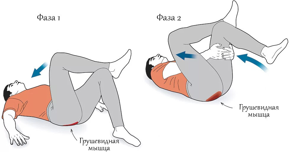 Лечение синдрома грушевидной мышцы