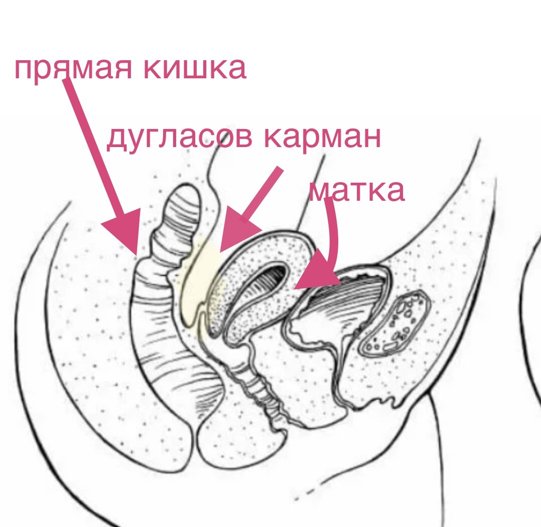 дугласов карман