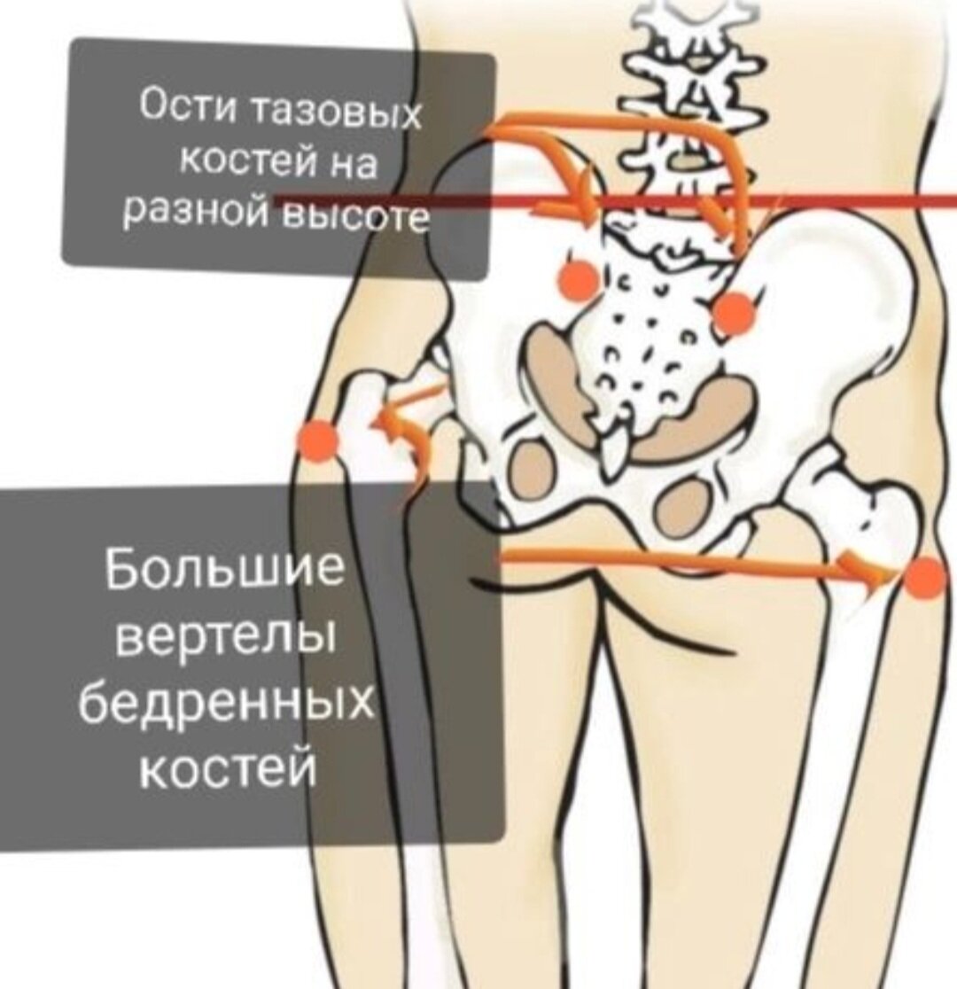 Схематично, но наглядно.