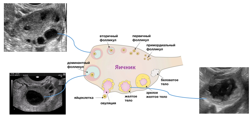 Структура яичника желтое тело