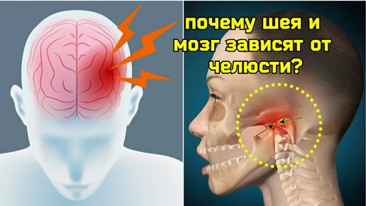 Деградация челюстно-подъязычной мышцы мешает крови течь в мозг, вредит шее. Уникальные методы укрепления