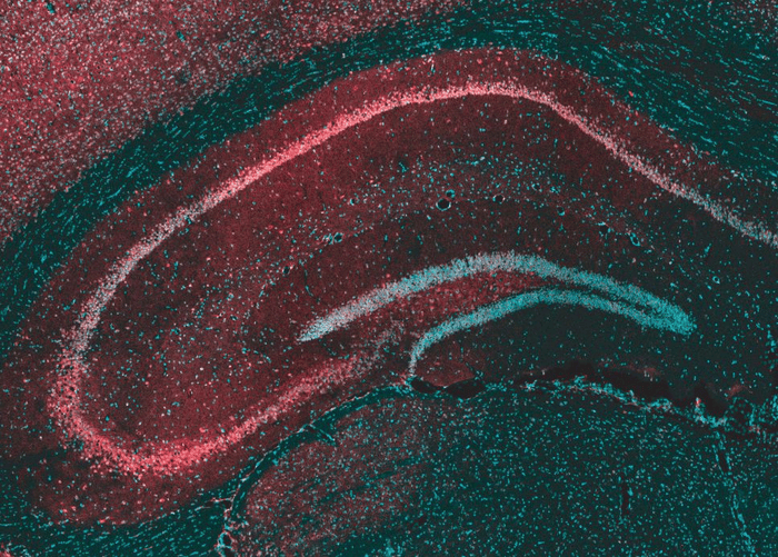    Срез гиппокампа мыши/ © Tsien et al, Courtesy of Cell Press