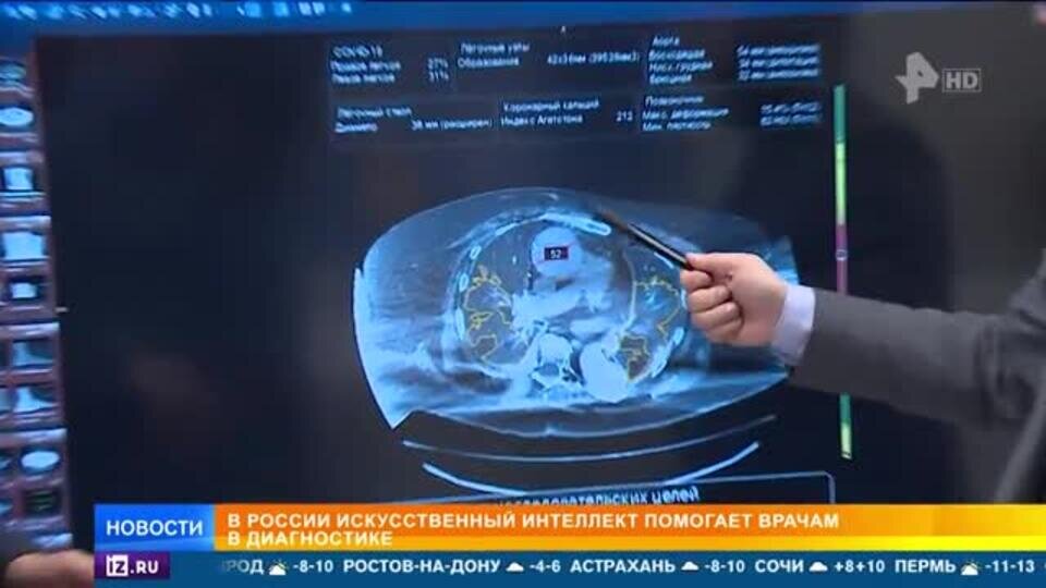    Как искусственный интеллект помогает врачам ставить диагнозы