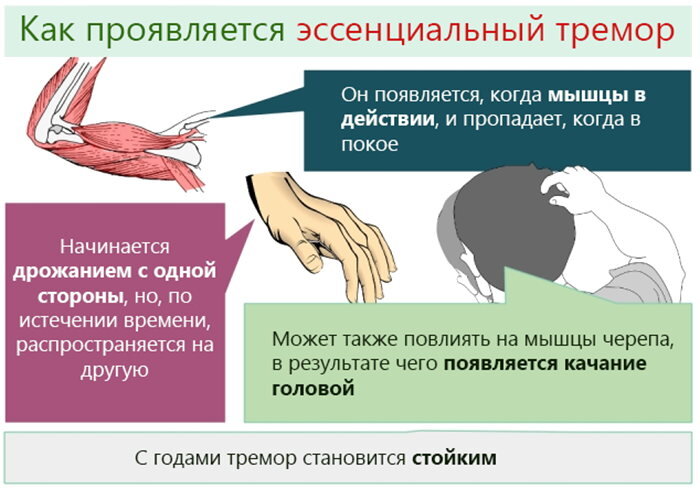 Эпилепсия: причины, симптомы, лечение