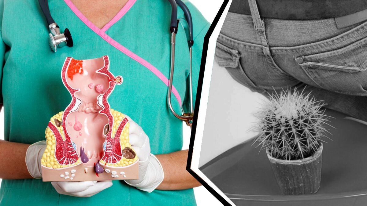 Начальные симптомы геморроя: как не запустить болезнь? | Теледоктор24 ...