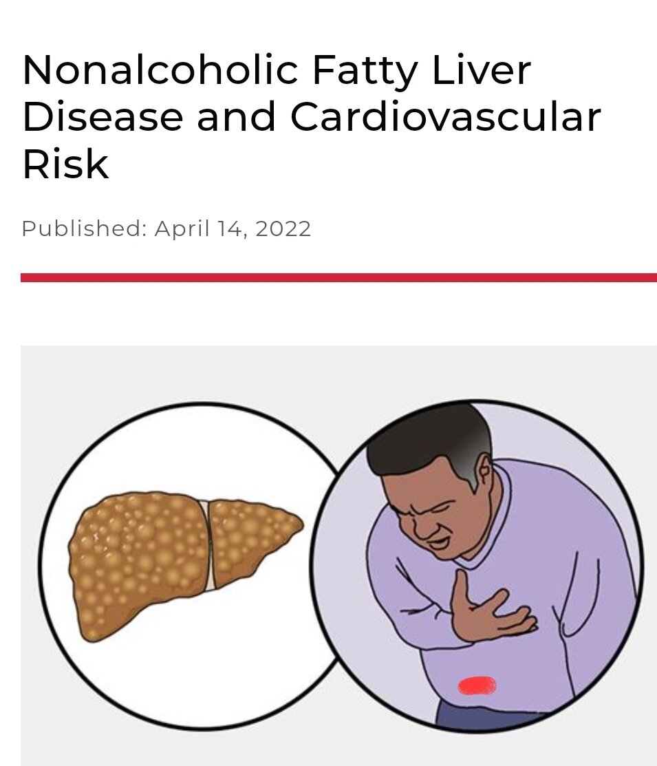 Nonalcoholic Fatty Liver Disease and Cardiovascular Risk