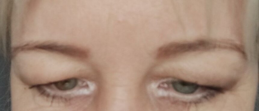 Просто какие то сардельки, вместо век. 