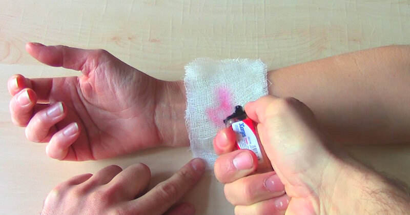 Зажигалка для оказания первой помощи 
Газ из зажигалки становится очень холодным при испарении, поэтому, сбрызнув место ушиба или ожога, можно охладить его и снять отек.
