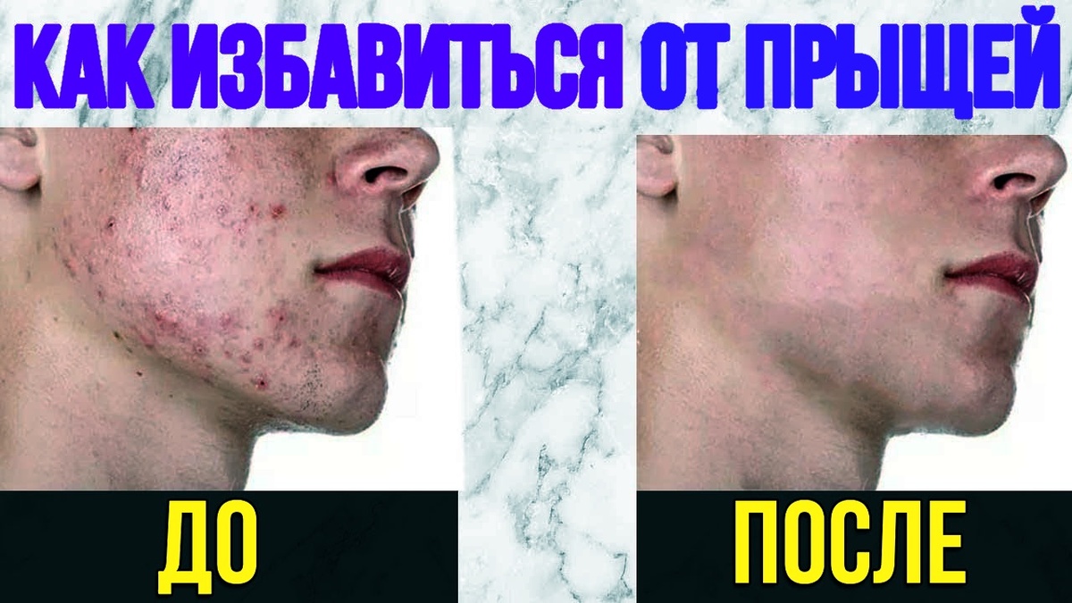 Спасибо, что дочитали статью! Берегите себя и своих близких!