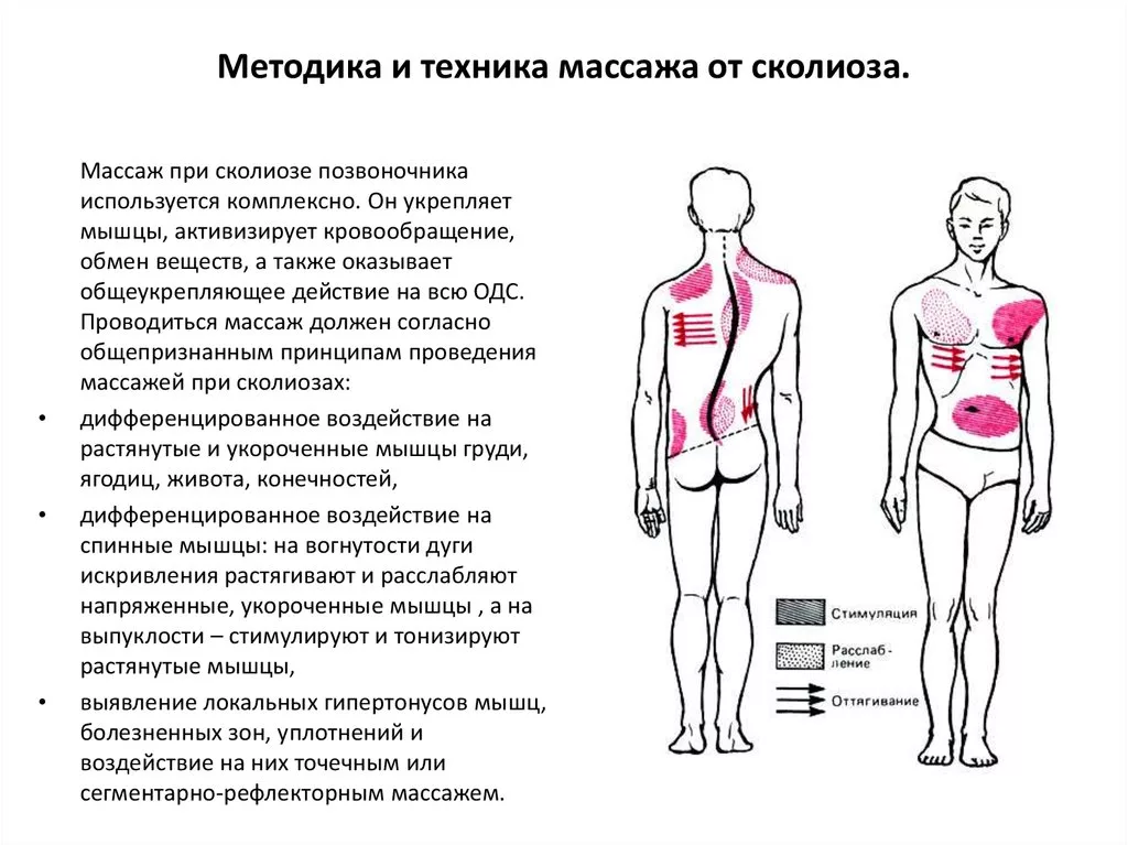 Массаж исправляющий сколиоз. Массаж спины при сколиозе у взрослых. Сколиоз массаж схема. Методика массажа при сколиозе 2 степени. Массаж при s образном сколиозе 1 степени.