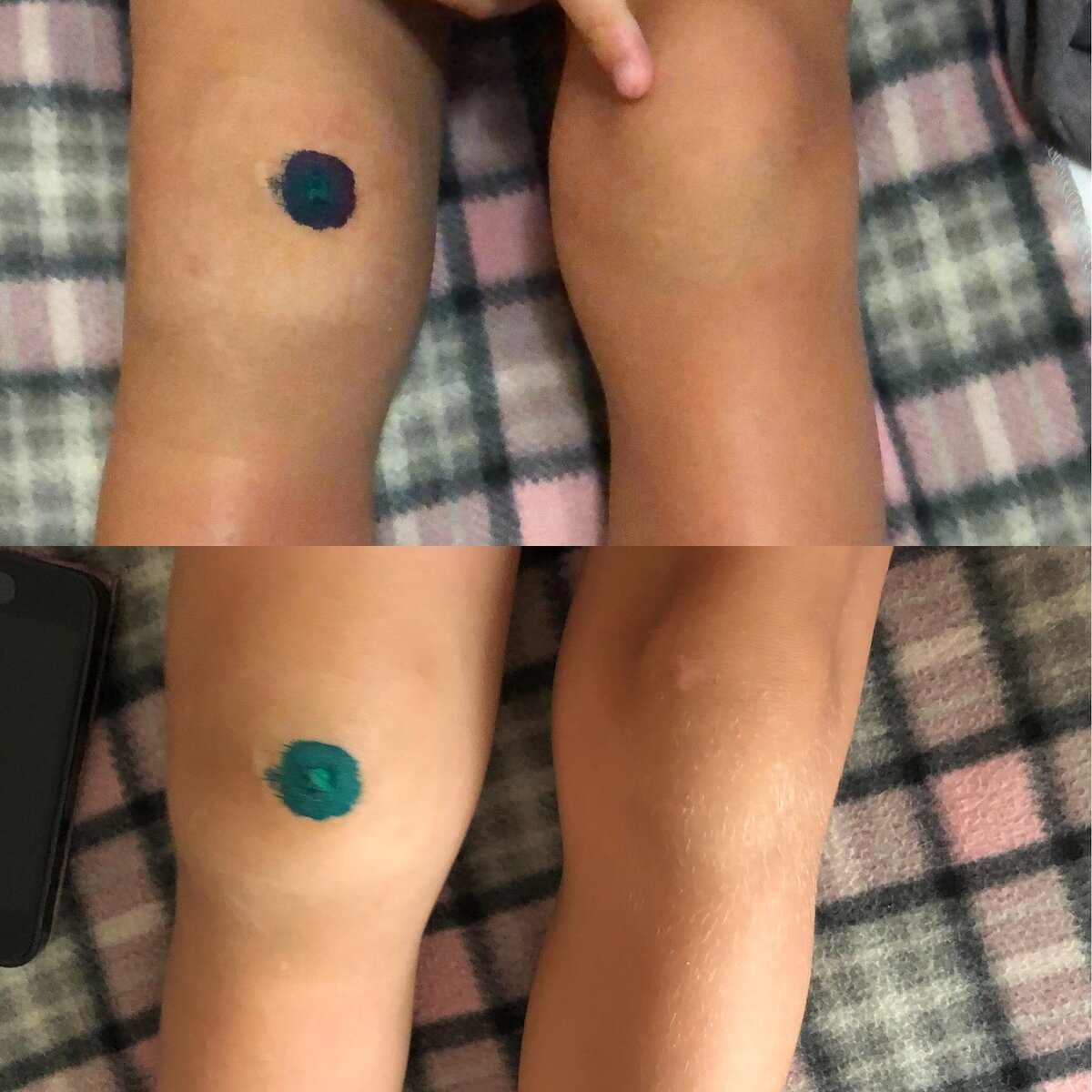 Фото из личного архива. Южная травма.