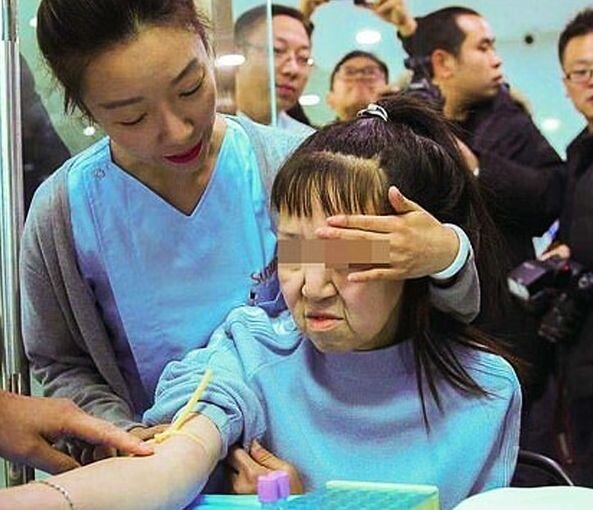 Перед операцией