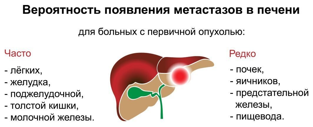 Рак метастазы в печень лечение