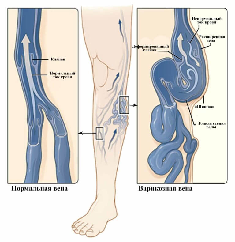 вены человека