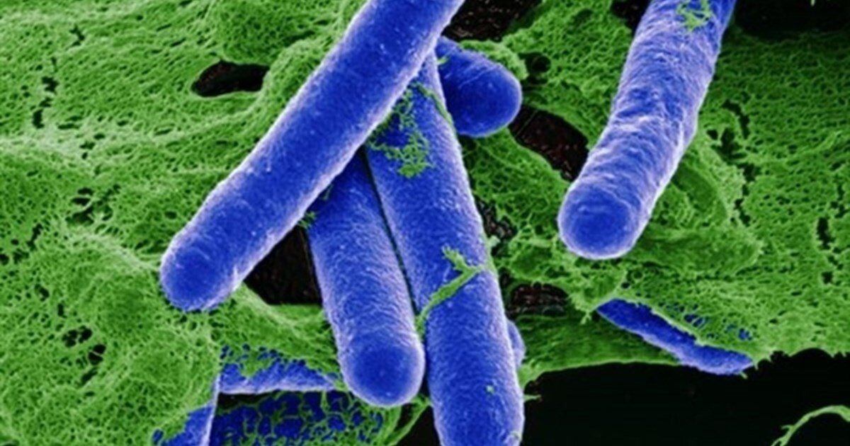 Бактерии Clostridium botulinum, производящие один из самых сильных ядов- ботулотоксин. Источник изображения:
