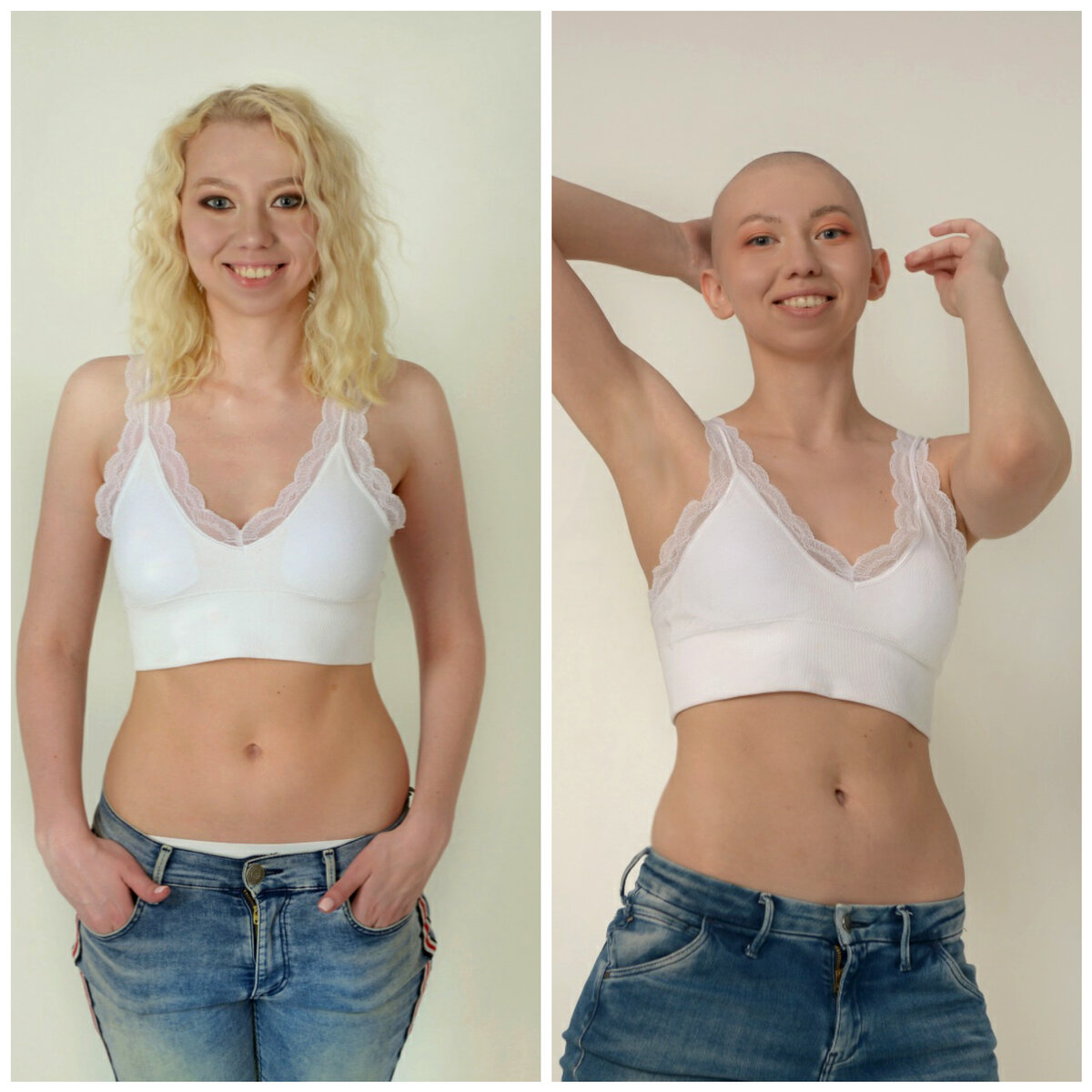 До/после. Разница в 1 ночь