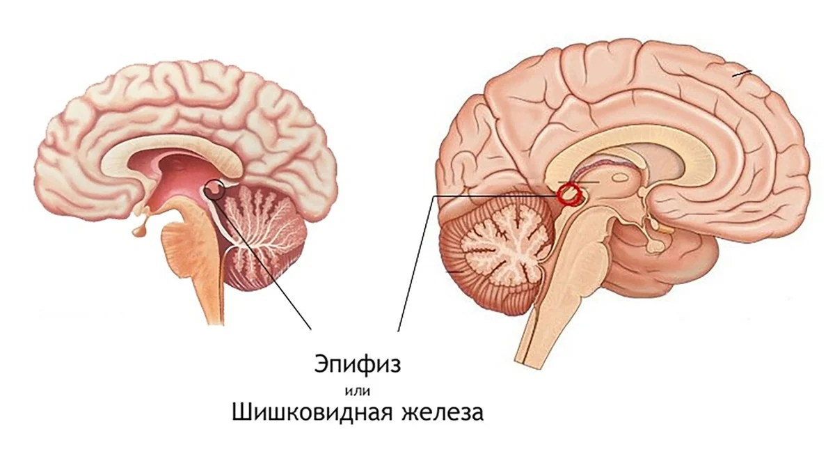 Что такое опухоль гипофиза?