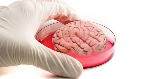    Психические расстройства будут исследовать на искусственном мозге