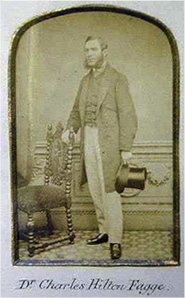 Чарльз Хилтон Фагге (30 июня 1838 - 18 ноября 1883). Фото с сайта https://www.cidjournal.com/article/S0738-081X(09)00135-7/fulltext
