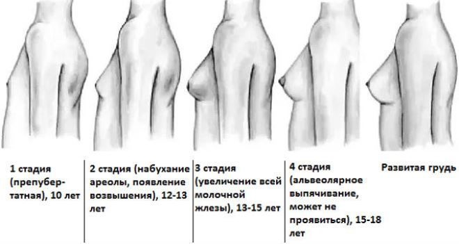 Какая должна быть грудь в 13 лет картинки