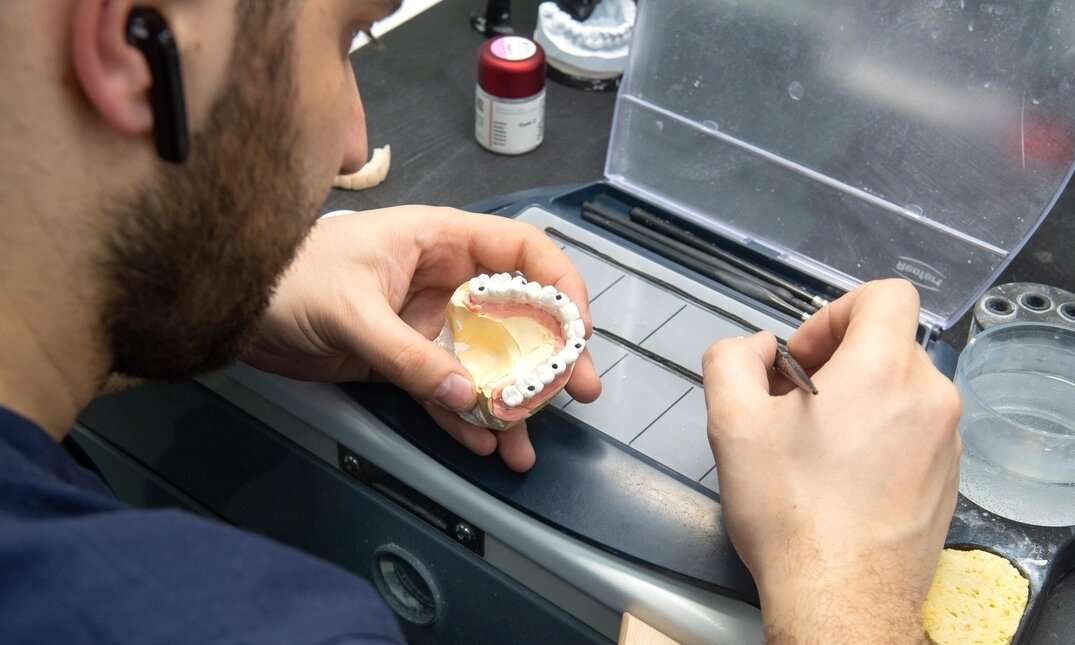 Зубной техник готовит адаптивный протез. Автор фото Доктор Федоров.